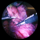 Illustration for article titled An 8K Endoscope Probably Shows More Than Anyone Really Wants To See
